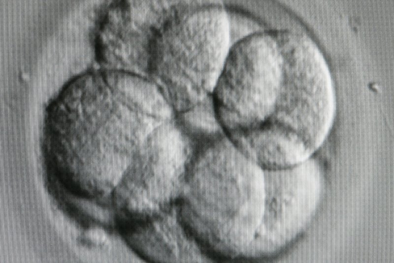 ber Wert und Wrde des Lebens | Bioethik | bpb.de